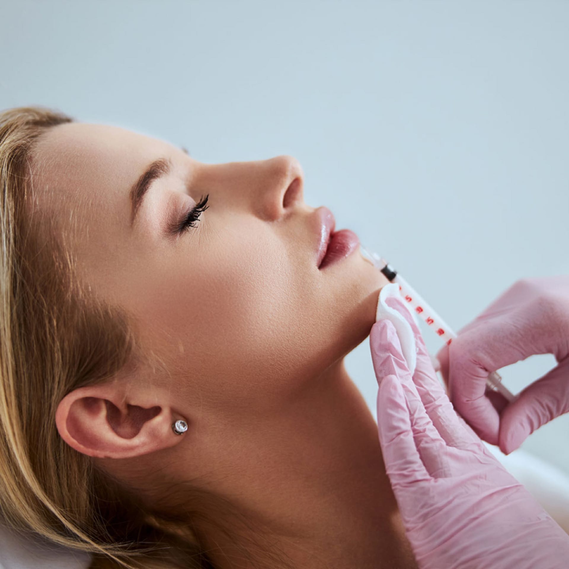 Dermal Fillers
